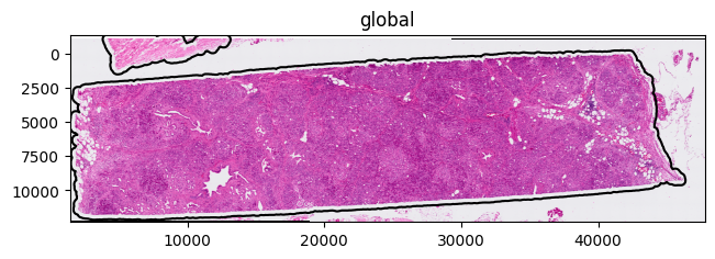 tissue_segmentation